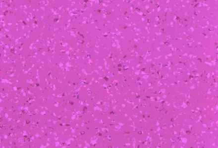 Линолеум DLV Flooring Perfect Safety 2 мм 5675 Paprika 2х15 м