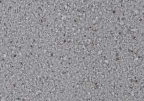Линолеум LG Hausys Durable Diorite DU 71832-01