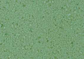 Линолеум LG Hausys Durable Diorite DU 7183A-01